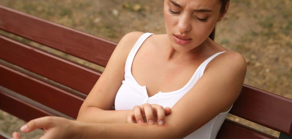 sintomas-dengue-picadura Mujer con picazón en brazo por dengue en parque