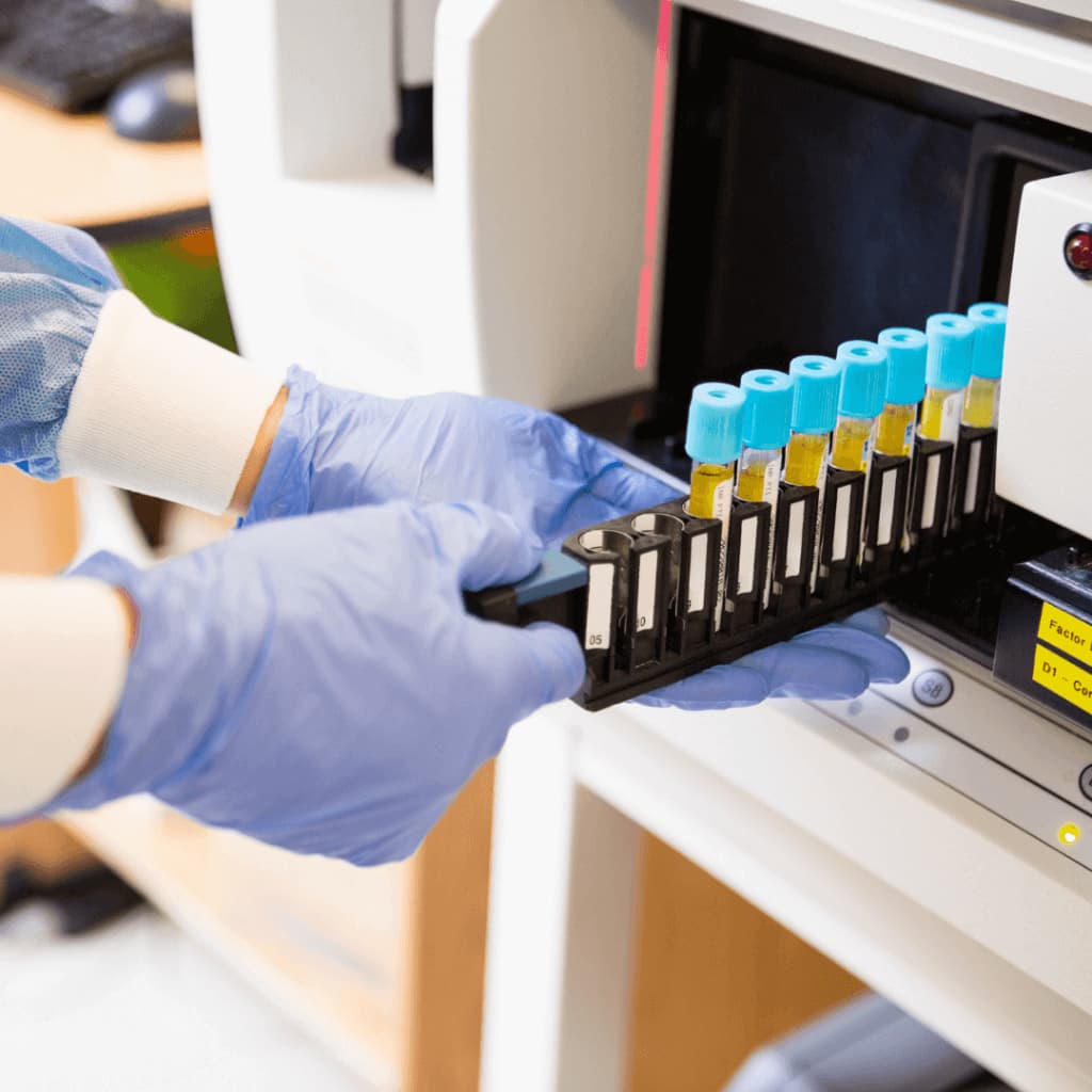 Procesamiento de muestras clínicas con tecnología de punta en LAB