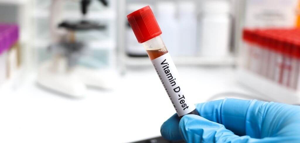 vitamina-d-test Mano con guante azul sosteniendo tubo de ensayo para test de vitamina D en laboratorio.